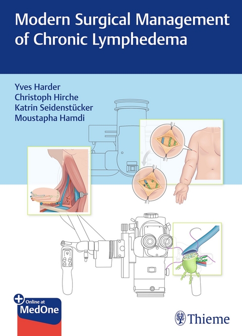 Modern Surgical Management of Chronic Lymphedema - 