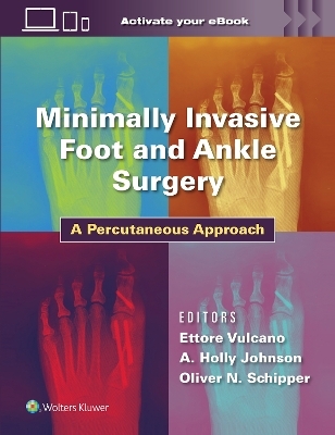 Minimally Invasive Foot and Ankle Surgery - Dr. Ettore Vulcano, A. Holland Johnson, Oliver Schipper