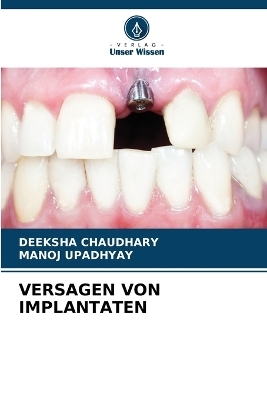 Versagen Von Implantaten
