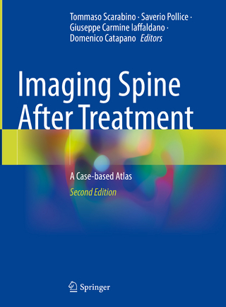 Imaging Spine After Treatment