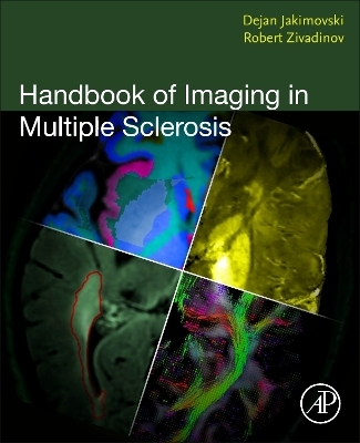 Handbook of Imaging in Multiple Sclerosis - 