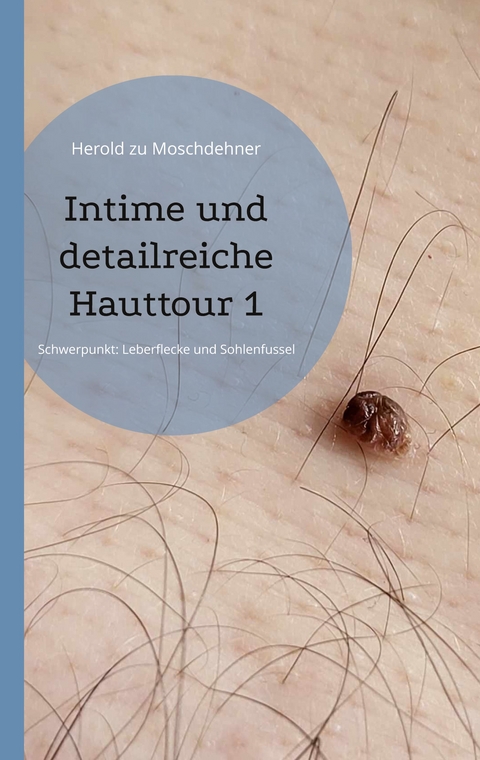 Intime und detailreiche Hauttour 1 - Herold zu Moschdehner