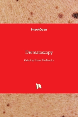 Dermatoscopy