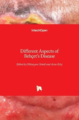 Different Aspects of Behçet's Disease