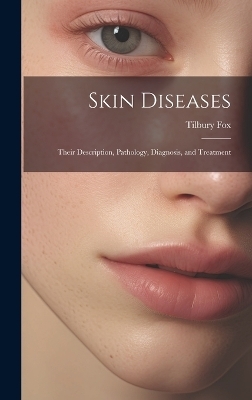 Skin Diseases
