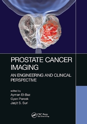 Prostate Cancer Imaging