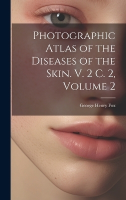 Photographic Atlas of the Diseases of the Skin. V. 2 C. 2, Volume 2 - George Henry Fox