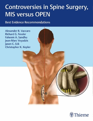 Controversies in Spine Surgery, MIS versus OPEN