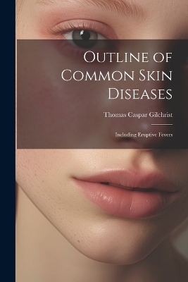 Outline of Common Skin Diseases - Thomas Caspar Gilchrist