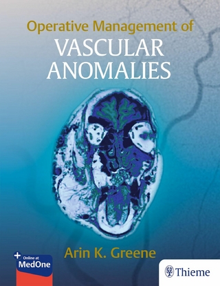 Operative Management of Vascular Anomalies
