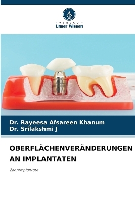 Oberfl&auml;chenver&auml;nderungen an Implantaten - Dr Rayeesa Afsareen Khanum, Dr Srilakshmi J