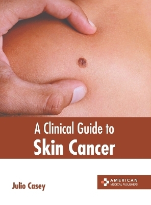 A Clinical Guide to Skin Cancer
