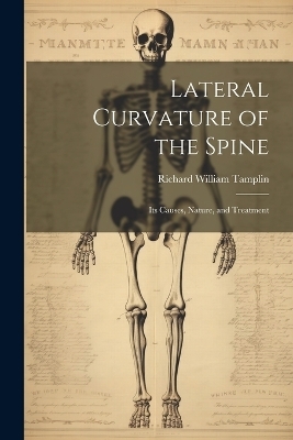 Lateral Curvature of the Spine