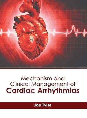 Mechanism and Clinical Management of Cardiac Arrhythmias