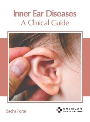 Inner Ear Diseases: A Clinical Guide