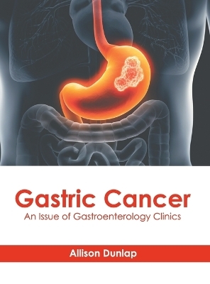 Gastric Cancer