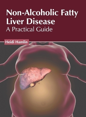 Non-Alcoholic Fatty Liver Disease: A Practical Guide