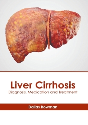 Liver Cirrhosis: Diagnosis, Medication and Treatment - 