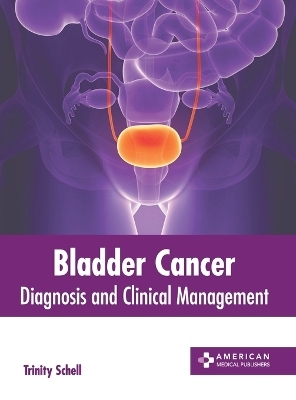 Bladder Cancer: Diagnosis and Clinical Management