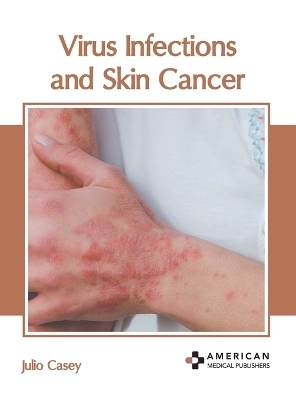 Virus Infections and Skin Cancer - 