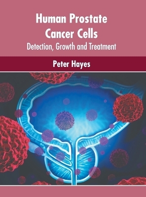Human Prostate Cancer Cells: Detection, Growth and Treatment