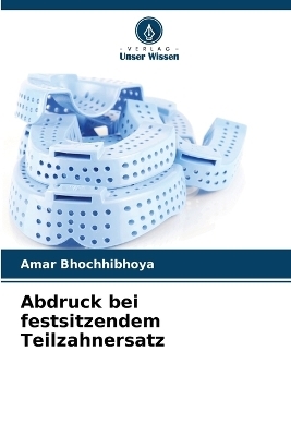 Abdruck bei festsitzendem Teilzahnersatz