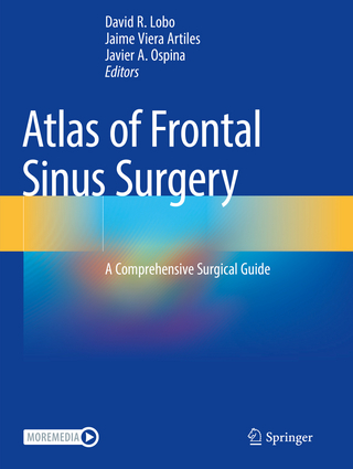 Atlas of Frontal Sinus Surgery