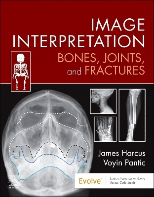 Image Interpretation: Bones, Joints, and Fractures