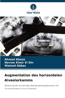 Augmentation des horizontalen Alveolarkamms