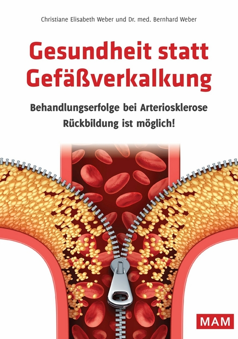 Gesundheit statt Gef&auml;&szlig;verkalkung - Dr. med. Bernhard Weber, Christiane Elisabeth Weber