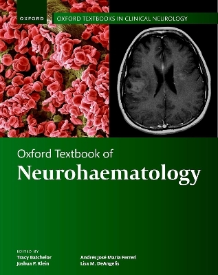Oxford Textbook of Neurohaematology - 