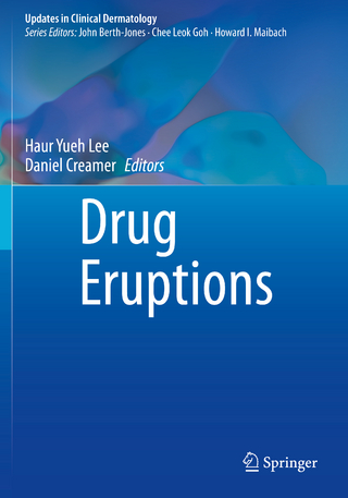 Drug Eruptions