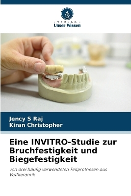 Eine INVITRO-Studie zur Bruchfestigkeit und Biegefestigkeit