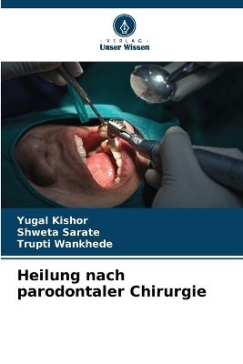 Heilung nach parodontaler Chirurgie - YUGAL KISHOR, Shweta Sarate, Trupti Wankhede