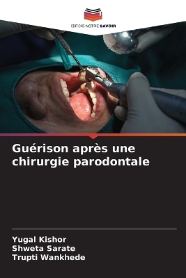 Gu&eacute;rison apr&egrave;s une chirurgie parodontale - YUGAL KISHOR, Shweta Sarate, Trupti Wankhede