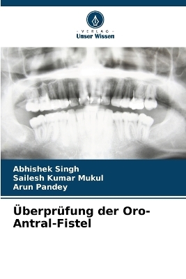 &Uuml;berpr&uuml;fung der Oro-Antral-Fistel - Abhishek Singh, Sailesh Kumar Mukul, Arun Pandey