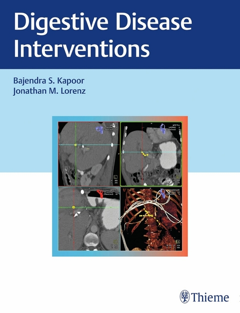 Digestive Disease Interventions - Baljendra Kapoor, Jonathan M. Lorenz