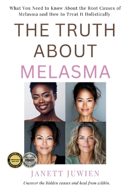 The Truth About Melasma