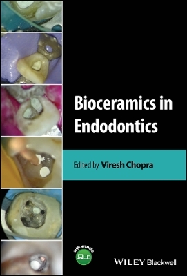 Bioceramics in Endodontics - 