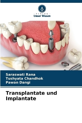 Transplantate und Implantate - Saraswati Rana, Tushyata Chandhok, Pawan Dangi