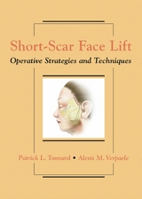 Short-Scar Face Lift - Patrick Tonnard, Alexis Verpaele