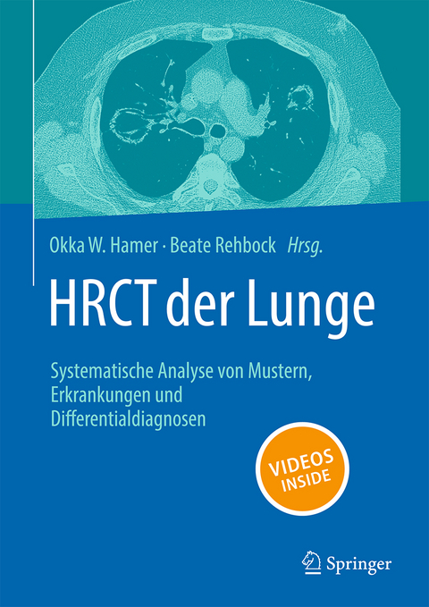 HRCT der Lunge - 