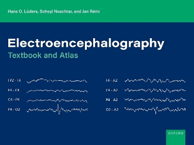 Electroencephalography - Hans O. L&uuml;ders, Soheyl Noachtar, Jan R&eacute;mi