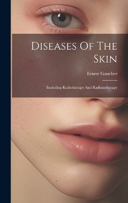 Diseases Of The Skin