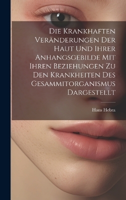 Die Krankhaften Ver&auml;nderungen Der Haut Und Ihrer Anhangsgebilde Mit Ihren Beziehungen Zu Den Krankheiten Des Gesammitorganismus Dargestellt - Hans Hebra