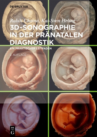 3D-Sonographie in der pränatalen Diagnostik