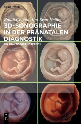 3D-Sonographie in der pränatalen Diagnostik - Rabih Chaoui, Kai-Sven Heling