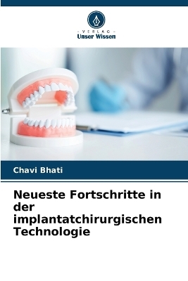 Neueste Fortschritte in der implantatchirurgischen Technologie - Chavi Bhati