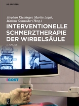 Interventionelle Schmerztherapie der Wirbelsäule - 