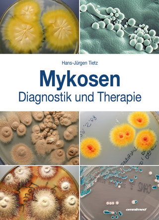Mykosen - Tietz Hans-Jürgen